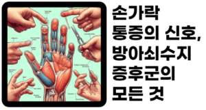 손가락이 굳어지는 듯한 느낌, 움직일 때마다 '딸깍'하는 소리가 들린다면 방아쇠수지증후군을 의심해 볼 때입니다. 이 질환은 손가락 힘줄에 문제가 생겨 발생하는데, 초기에는 간과하기 쉬운 증상들이 점차 일상을 불편하게 만들 수 있습니다. 지금부터 방아쇠수지증후군의 원인부터 예방법까지, 알아야 할 모든 정보를 상세히 알려드리겠습니다.