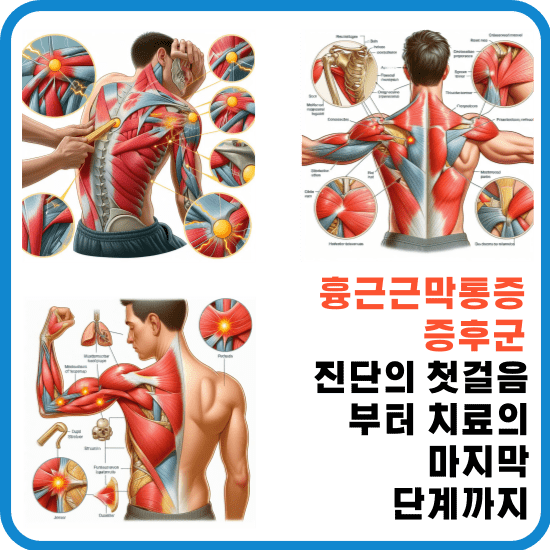 안녕하세요, 여러분. 오늘은 흉근근막통증증후군에 대해 이야기하려고 합니다. 이 질환은 많은 사람들이 겪지만, 아직까지 잘 알려져 있지 않습니다. 이 포스트를 통해 흉근근막통증증후군에 대한 이해를 높이고, 이 질환으로 힘들어하는 환자와 그 가족들에게 도움이 될 수 있기를 바랍니다.