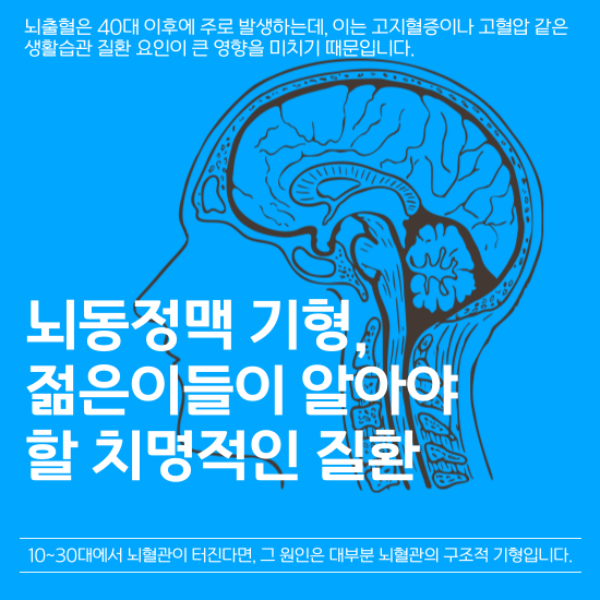 뇌출혈에 관한 질환으로 우리가 흔히 알고 있는 뇌출혈은 40대 이후에 주로 발생하는데, 이는 고지혈증이나 고혈압 같은 생활습관 질환 요인이 큰 영향을 미치기 때문입니다. 그런데 10~30대에서 뇌혈관이 터진다면, 그 원인은 대부분 뇌혈관의 구조적 기형입니다. 그 중에서도 '뇌동정맥 기형’은 젊은 나이에 뇌출혈을 일으키는 주범이죠. 이 질환은 다양한 후유증과 장애, 심지어 사망으로 이어질 수 있어 적극적인 치료가 필요합니다.